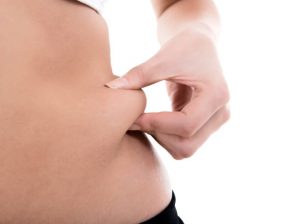 CENTRAL-Day-Surgery tummy tuck Adelaide
